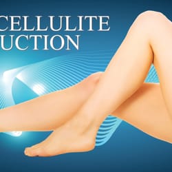 laser skinstitute tattoo removal 2397 nw military hwy san laser skinstitute tattoo removal 2397 nw military hwy san