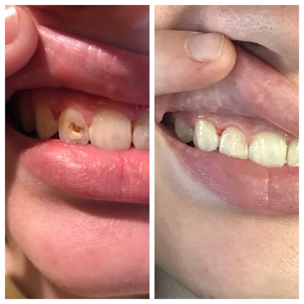 image of business Gilroy Dental Smiles