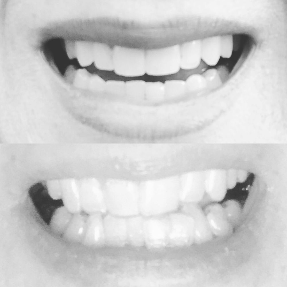 Are mgh facial pain clinic advise Simply mgh facial pain clinic very