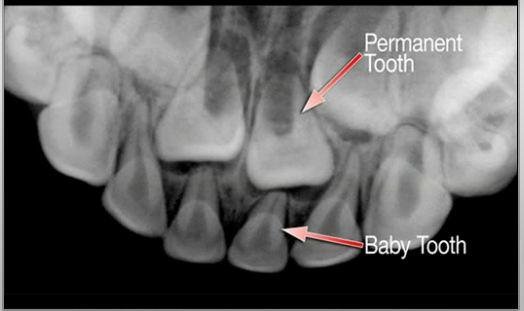 image of business Crossroads Dental
