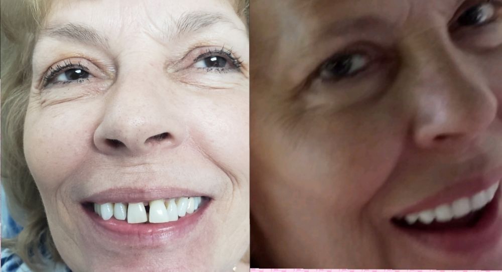 image of business NewMe Dental Implant Specialist