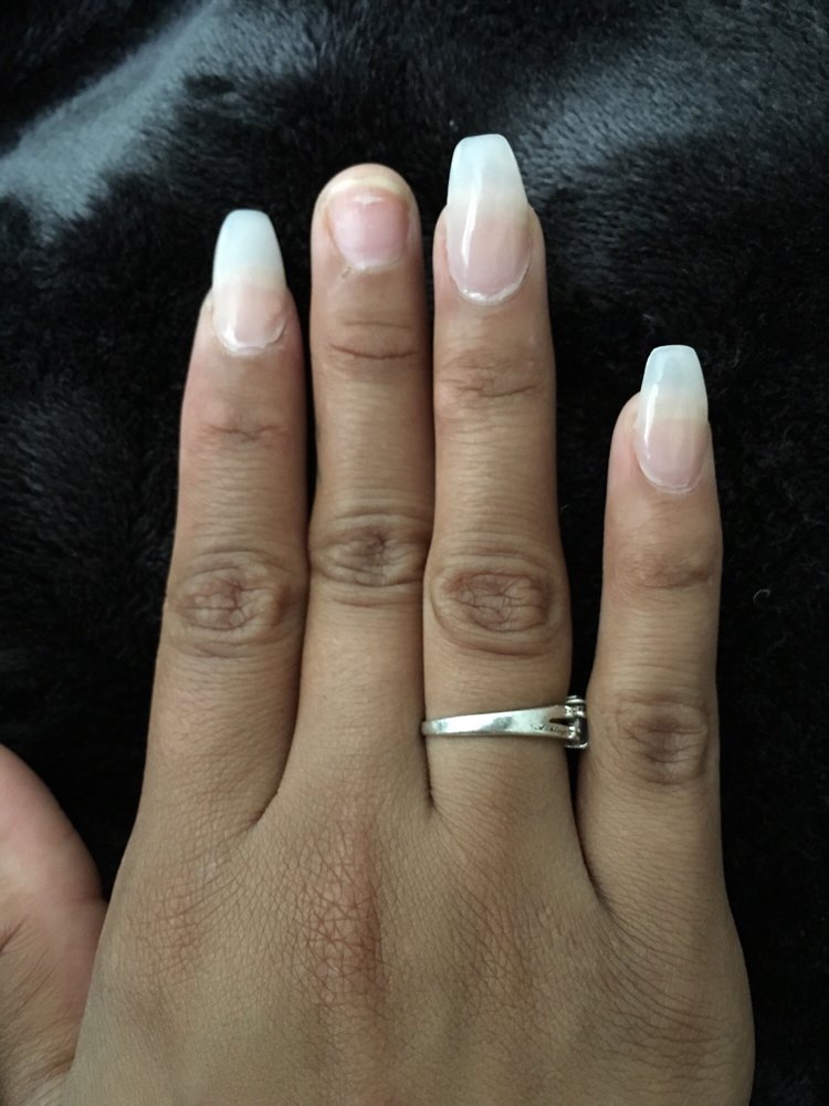 Middle Finger Nail Popped Off After Less Than A Week And Other Nails