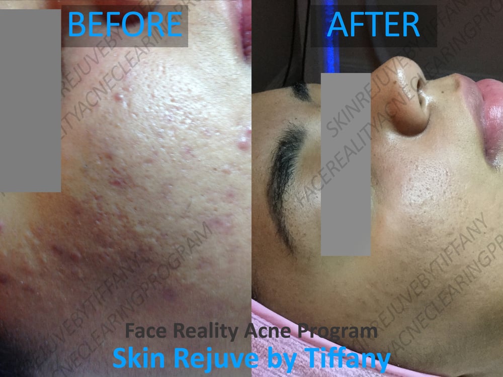 ashley massaro nude in playboy angeles care facial los skin treatment