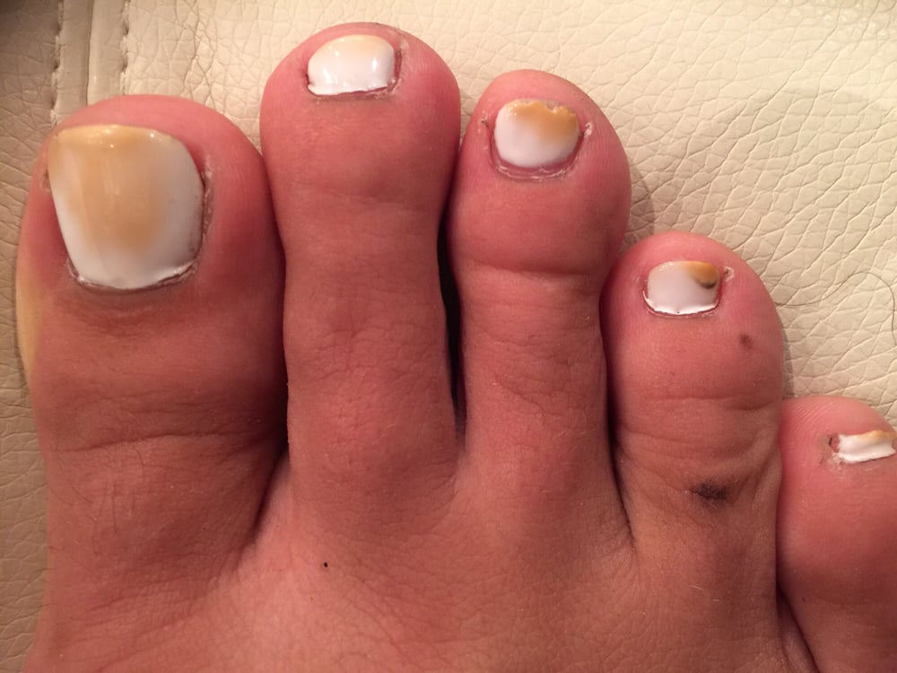 Niagara Falls Nails & Spa 20 Photos Nail Salons 5233 Stanley Avenue, Niagara Falls, ON