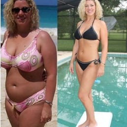 Does ultrasound weight loss really work image 7