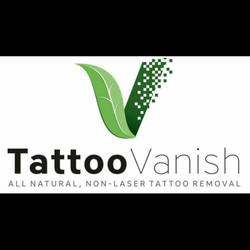 tampa tattoo vanish tattoo removal 14902 n florida ave tampa tattoo vanish tattoo removal 14902 n florida ave