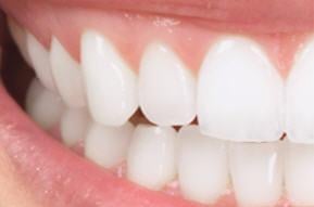 image of business Ipswich Smiles