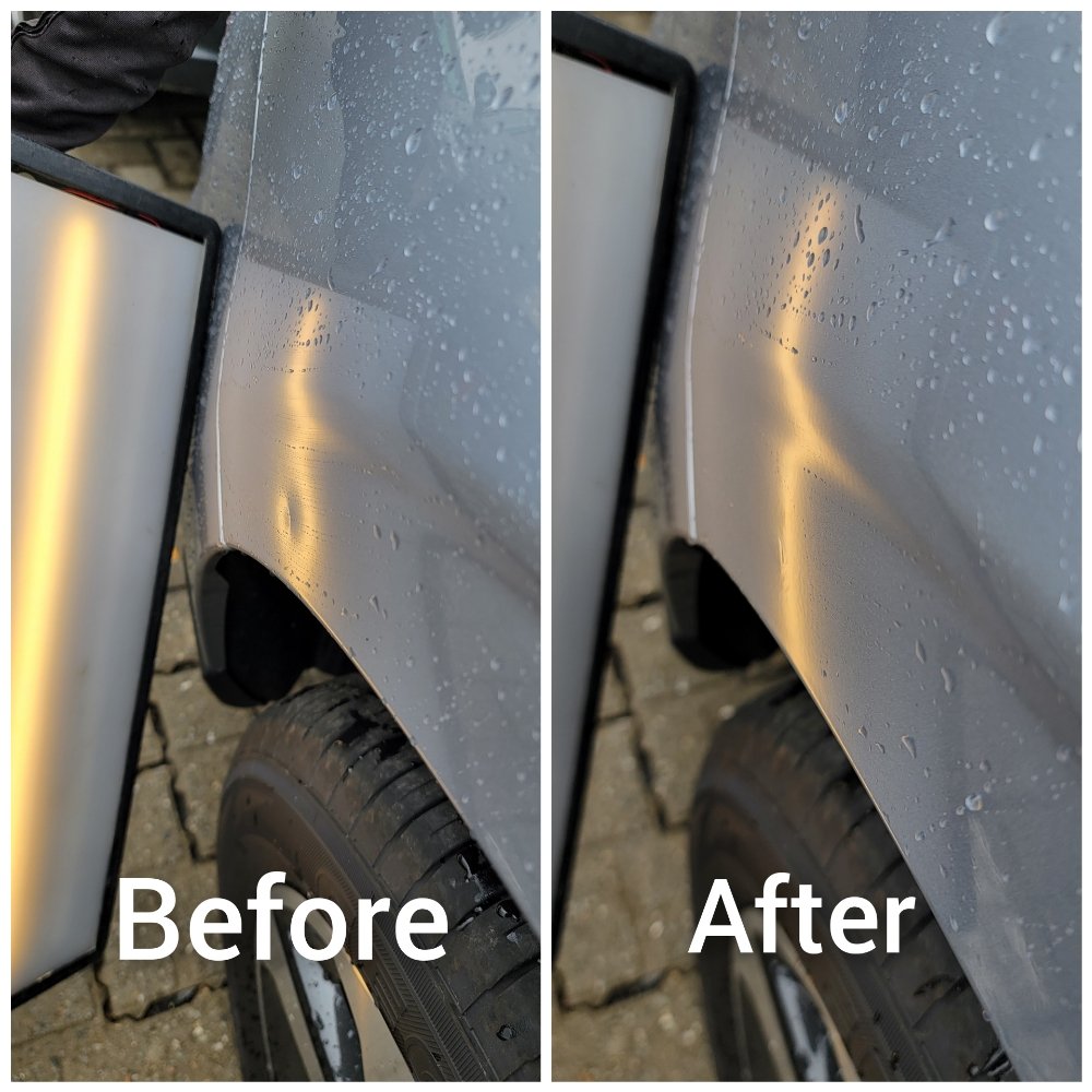 Pao Dent Removal
