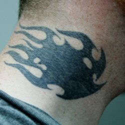 under my skin tattoo removal tattoo removal 1736 e sunshine st under my skin tattoo removal tattoo removal 1736 e sunshine st