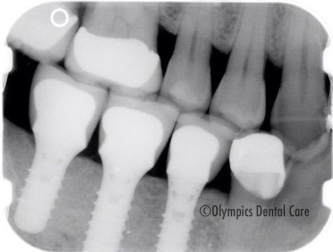 image of business Olympics Dental Care