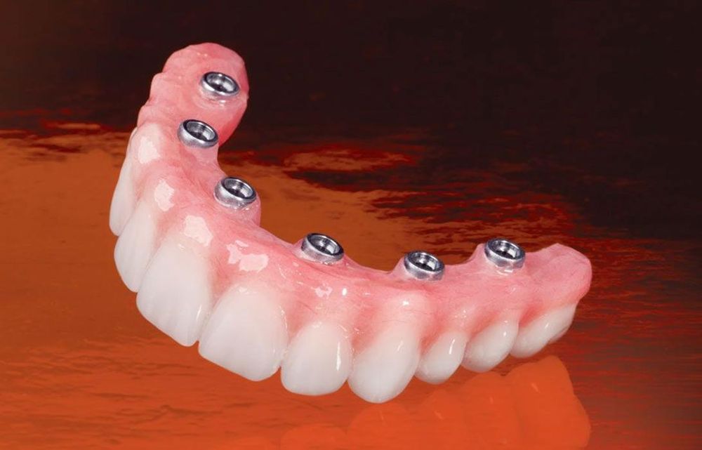 image of business Ohana Dental Implant Centers
