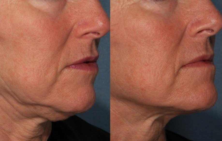 NOVA Derm Institute