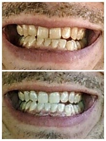 image of business Affordable dentures