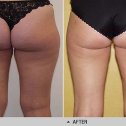 Arizona diet green tea weight loss picture 4