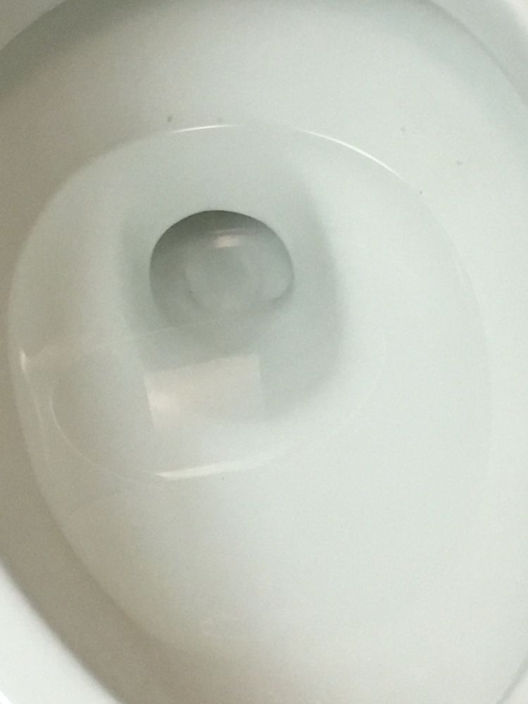Toilet Has Black Specks Of Some Type Residue Yelp Photo Of Country Inn Suites Beaufort Sc United States Toilet Has