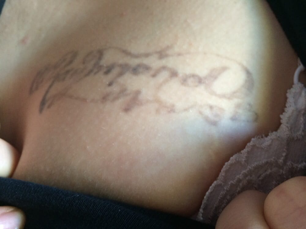 Inkoff.me - 10 Photos &amp; 15 Reviews - Tattoo Removal - 1151 