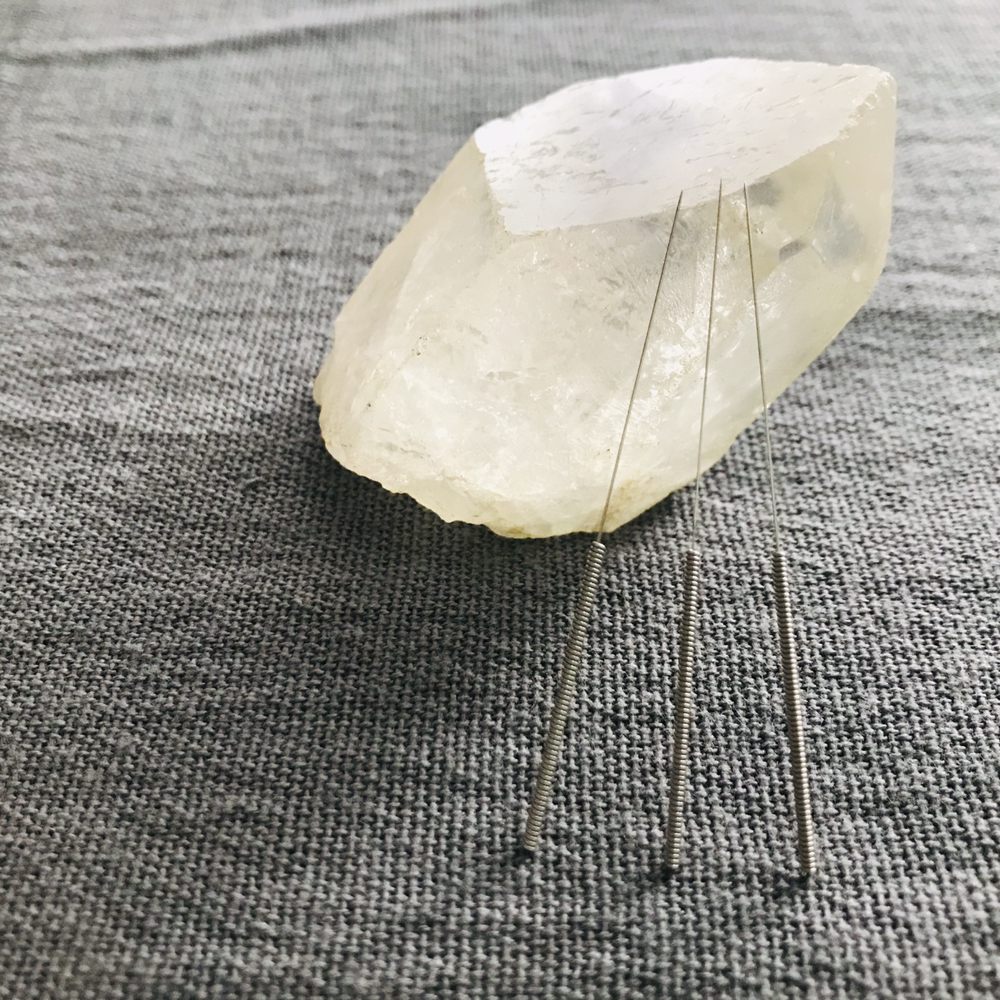 HealFlow Acupuncture