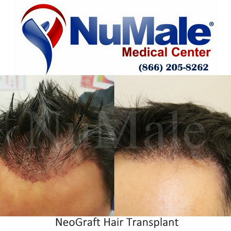 NuMale Medical Center - Omaha