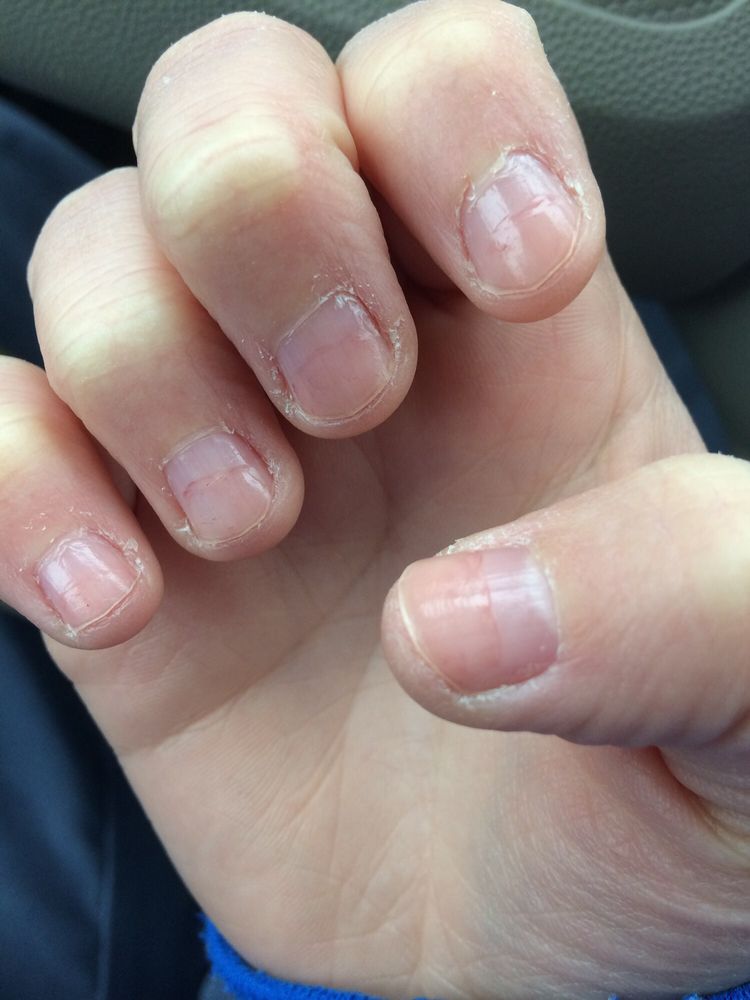 Beautiful Nails