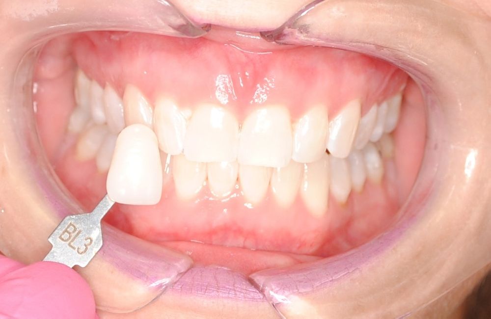 image of business San Ramon Dentist - Bollinger Canyon Dental