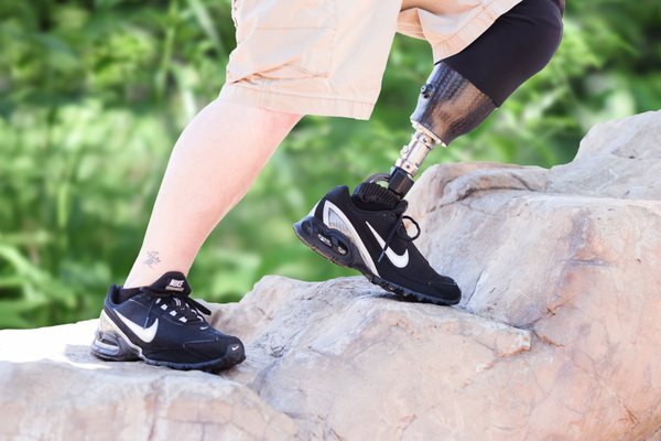 Innovative Prosthetics