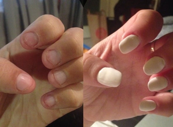 Before And After Hellen Did Silk Nails Transformed My Gross Photo Of Heather S Nail Salon Santa Monica Ca United States Before And