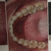 Clear Choice Orthodontics Orthodontists 320 E Edgewood Dr South