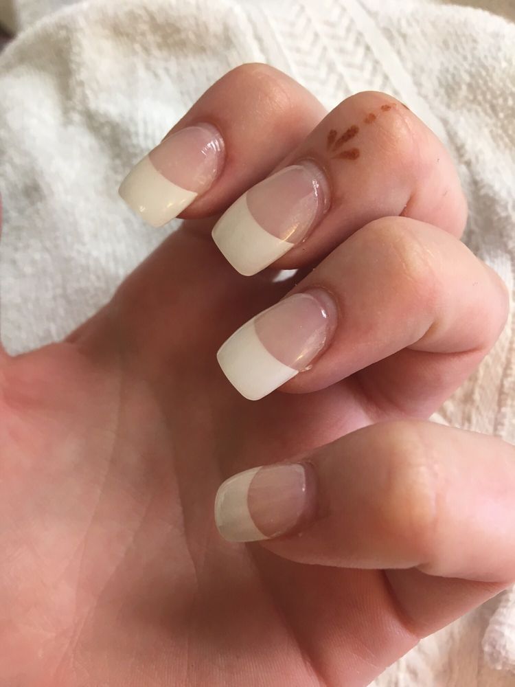 Lifting Of The Acrylic After A Week And Half Yelp Photo Of Nails Spa Center Corvallis Or United States Lifting