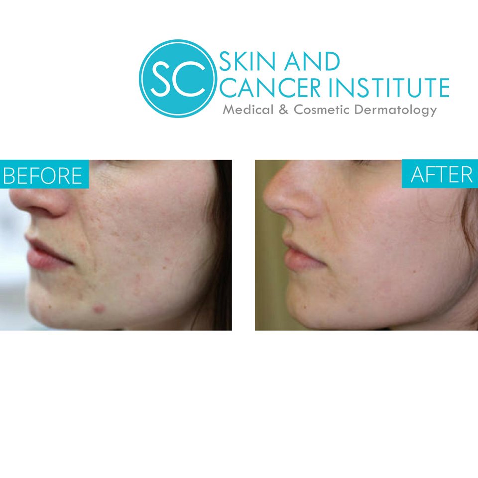 Turlock Dermatology & Skin Cancer