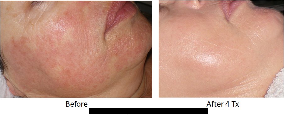 BodyBrite - Leesburg