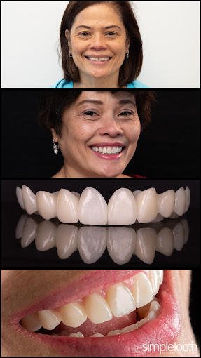 image of business theSimpleTooth - Dentist Foothill Ranch