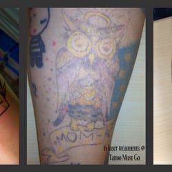 tattoo must go 10 photos tattoo removal 1780 s bellaire st tattoo must go 10 photos tattoo removal 1780 s bellaire st