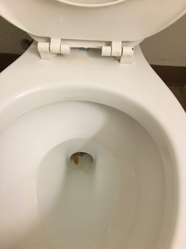 Bathroom Sink Yellow Stain toilet is dirty below the toilet lid yellow stain. toilet has shit Bathroom Sink Yellow Stain toilet is dirty below the toilet lid yellow stain. toilet has shit