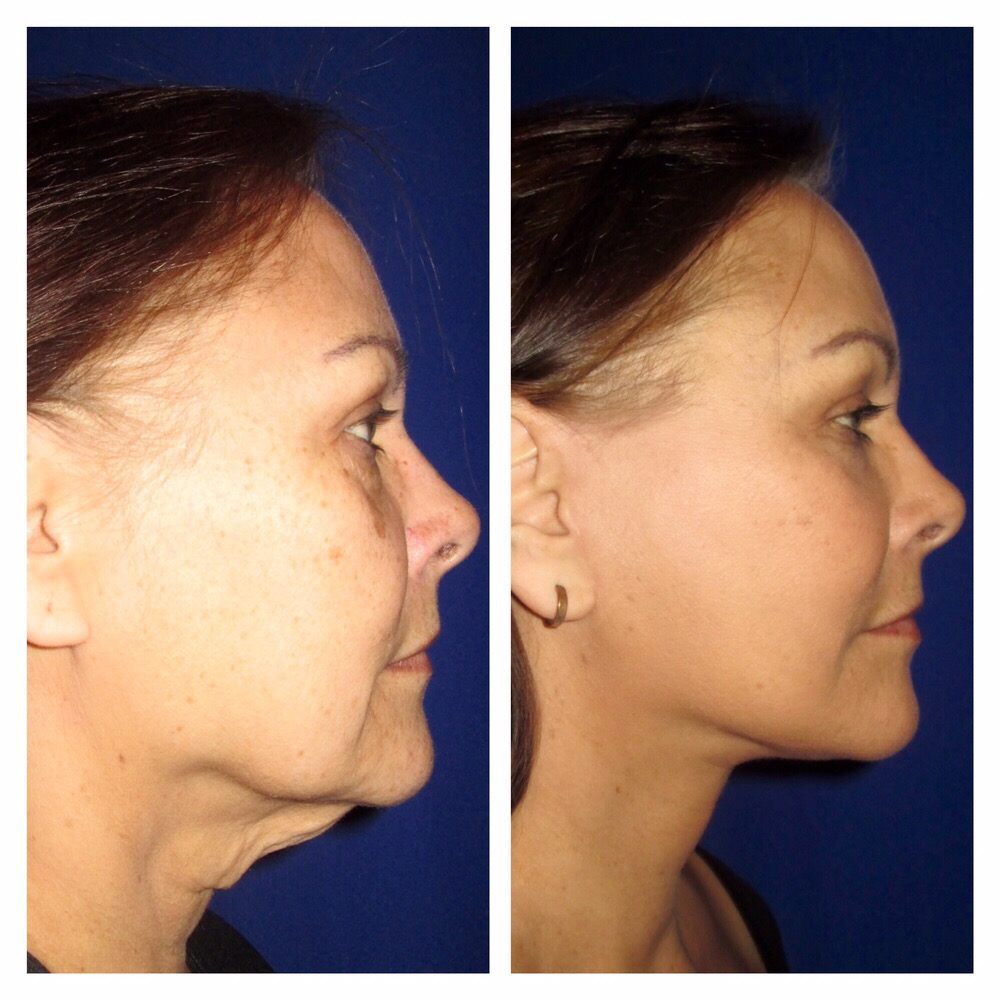 With center for facial cosmetics for Confirm. center for facial cosmetics apologise