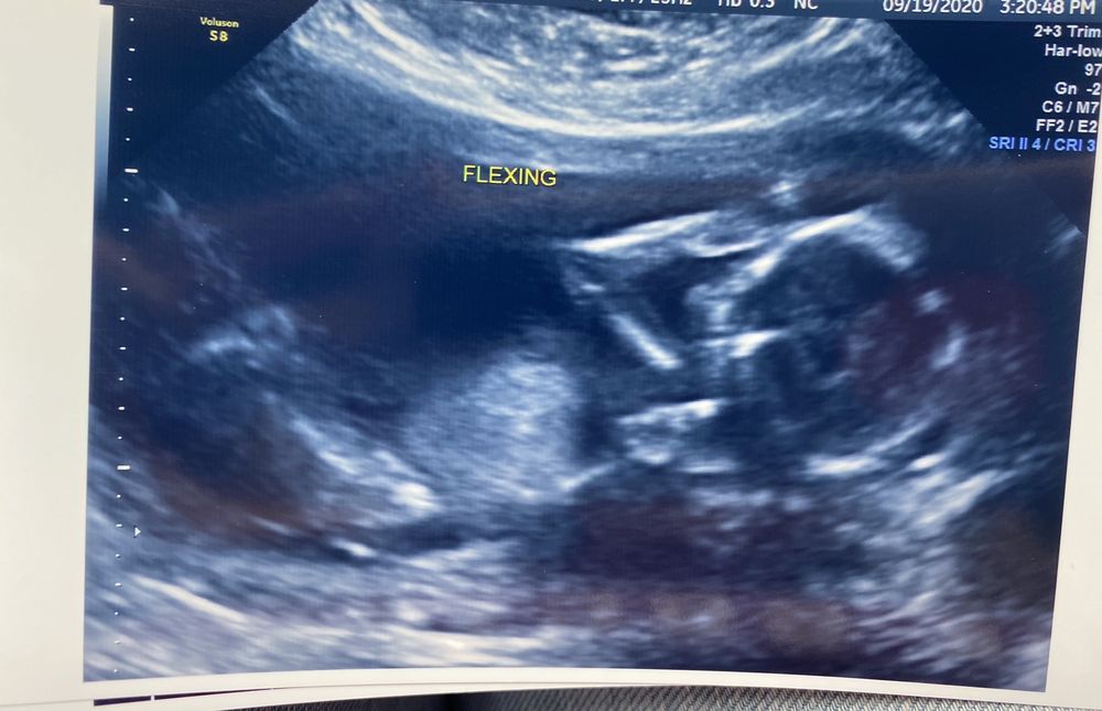 Jacksonville 4D Fetal Photo