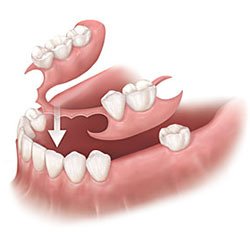 image of business Custom Dentures